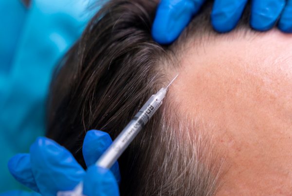 Growth Factor Hair Rejuvenation at The Wellness Co.