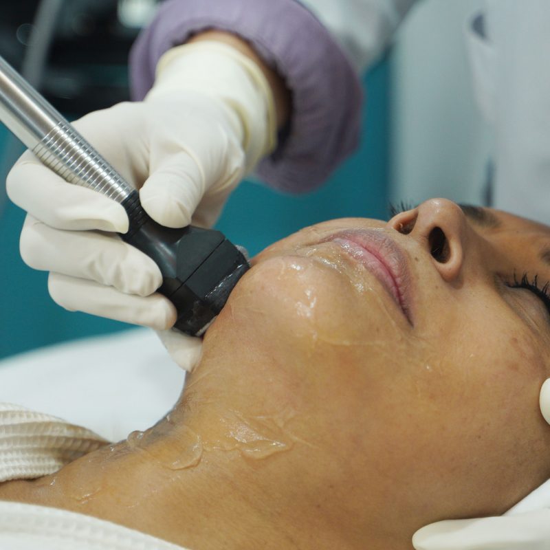 Transform Your Skin with Forma Therapy: Discover Its Impact on Skin Ageing