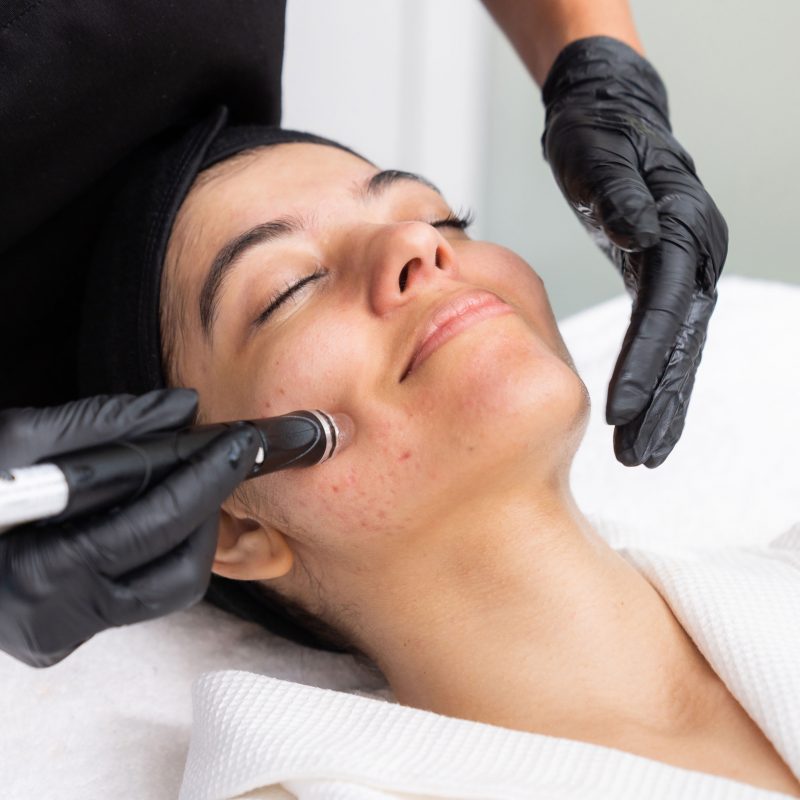 HydraFacial
