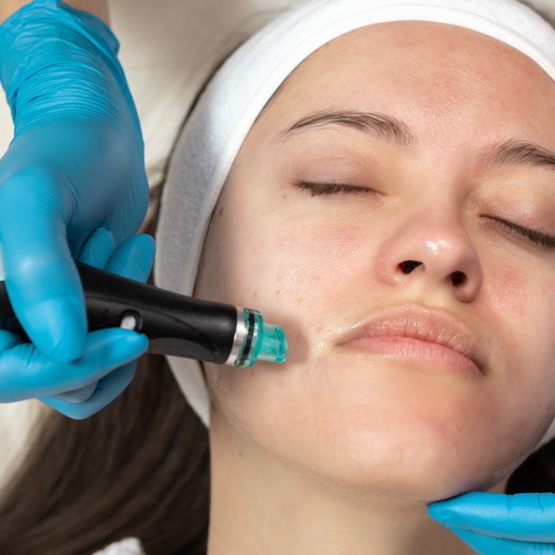 HydraFacial Treatment Results Timeline: What You’ll See Immediately vs. After 7 Days